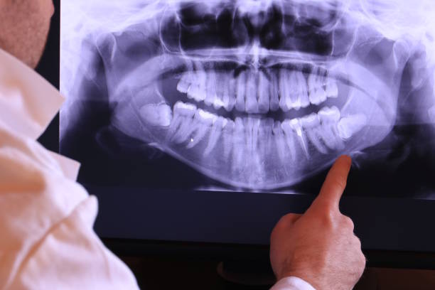 Best Emergency Dental Care for Broken or Chipped Teeth in Pine Ridge, FL